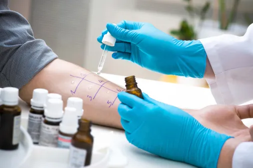 Allergie: test cutanei in 20 minuti al Dalla Rosa Prati