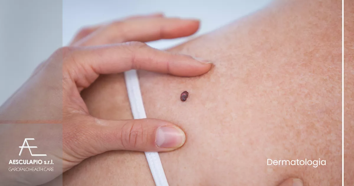 Nuova collaborazione: Dott.ssa Arianna Martinelli - dermatologa 